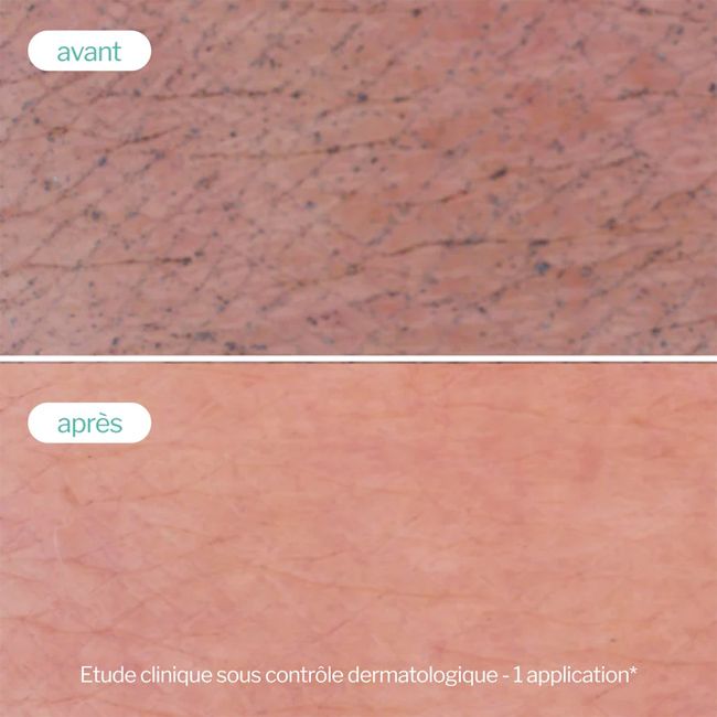 Nettoyant visage naturel Gelée Moussante Peau Nette Novexepert