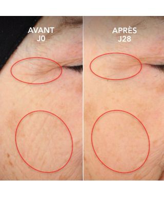 Sérum CEL™ Retinal - 30 ml