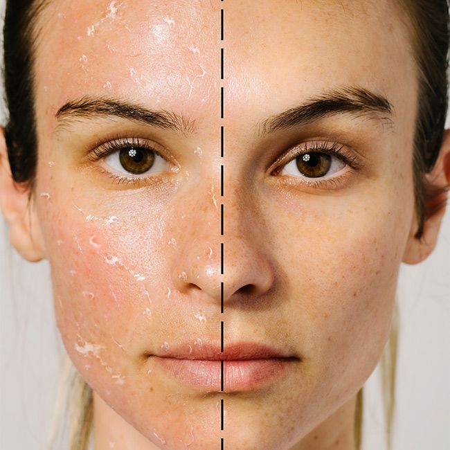 Gommage visage exfoliant Bioactive Rose Odacité