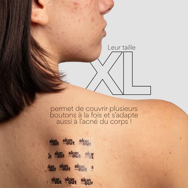 Patch anti bouton XL Hydrocolloïde Clear Skin and Out