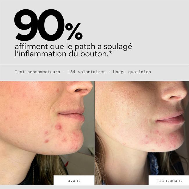 Patch anti bouton XL Hydrocolloïde Clear Skin and Out