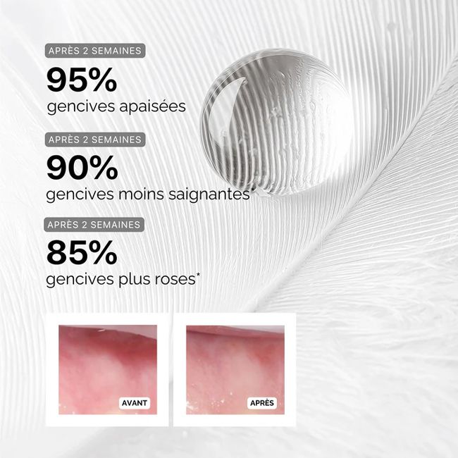 Soin gencives sérum régénérant intense The Smilist