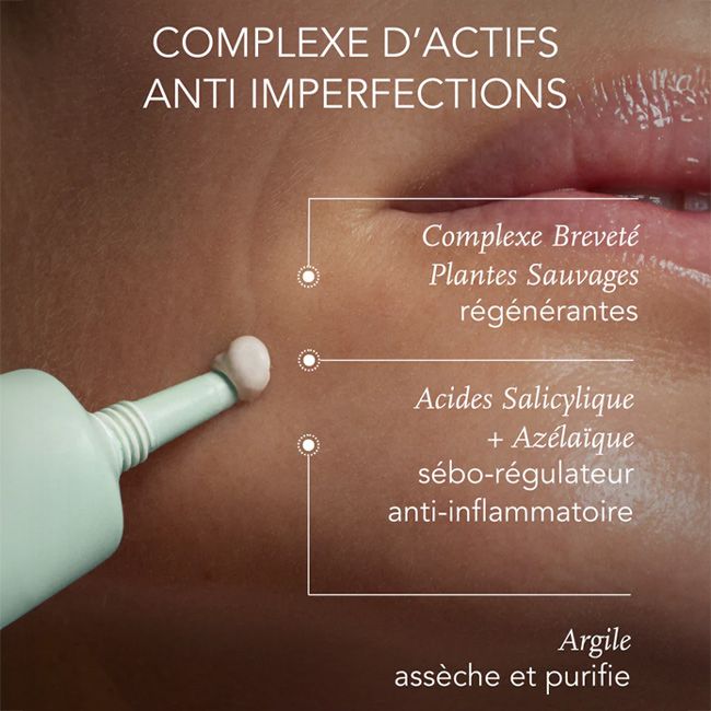 Stop-Boutons Paste - On The Wild Side I MonCornerB