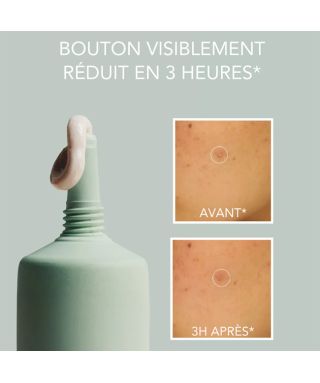 Pâte Stop-Boutons - 15 ml