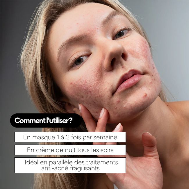 Masque anti-imperfection réparateur Cica Out Skin & Out