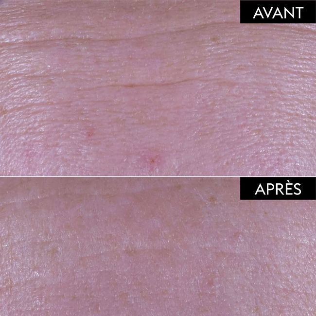 Fundamental Plumping Serum - Patyka I MonCornerB