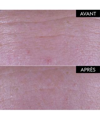 Repuplant Fondamental serum - 30 ml