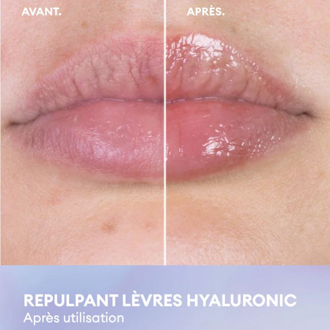 Baume à lèvres naturel soin repulpant hyaluronic Patyka