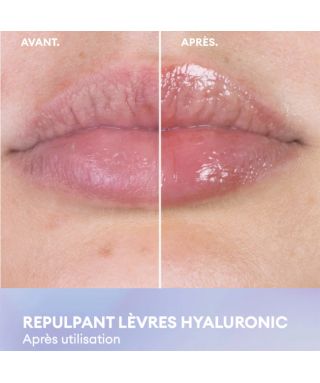 Hyaluronic Lip Plumping Care - 7 ml