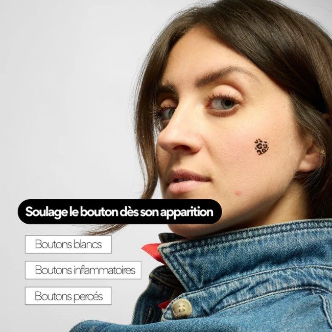 Patchs boutons léopard Skin and Out