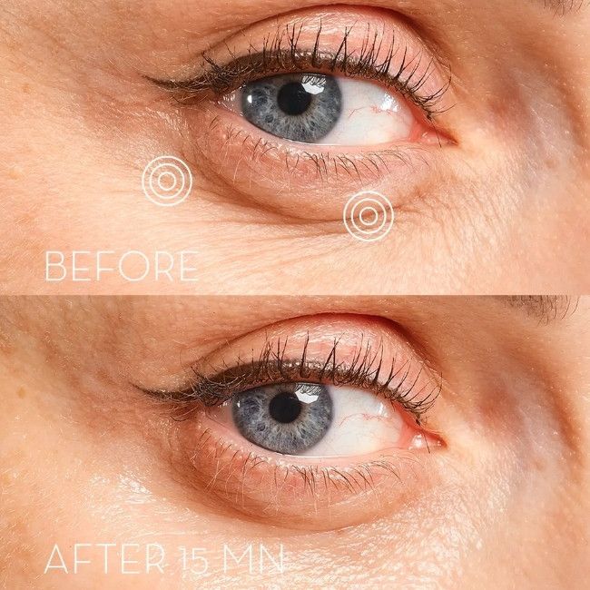 Patchs contour des yeux eye precision recipe