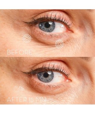 Patchs contour des yeux Eye Precision