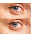 Patchs contour des yeux eye precision recipe