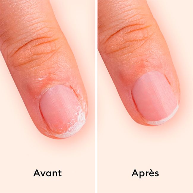 Soft Nail Strengthening Treatment - Manucurist - MonCornerB