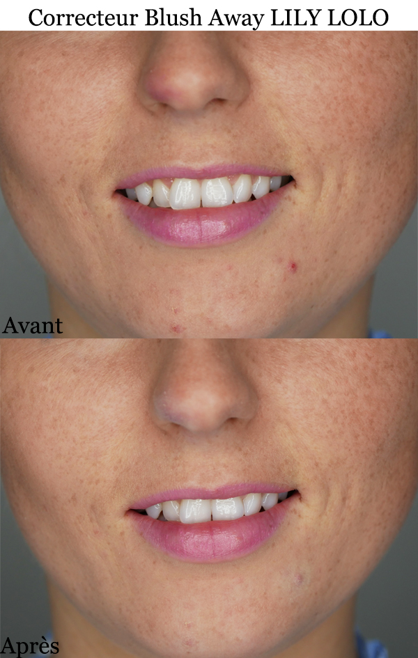 Correcteur LILY LOLO Blush Away Correcteur Vert Livraison GRATUITE
