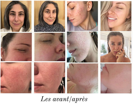 Face Spots