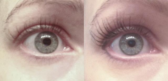 lashes serum before after