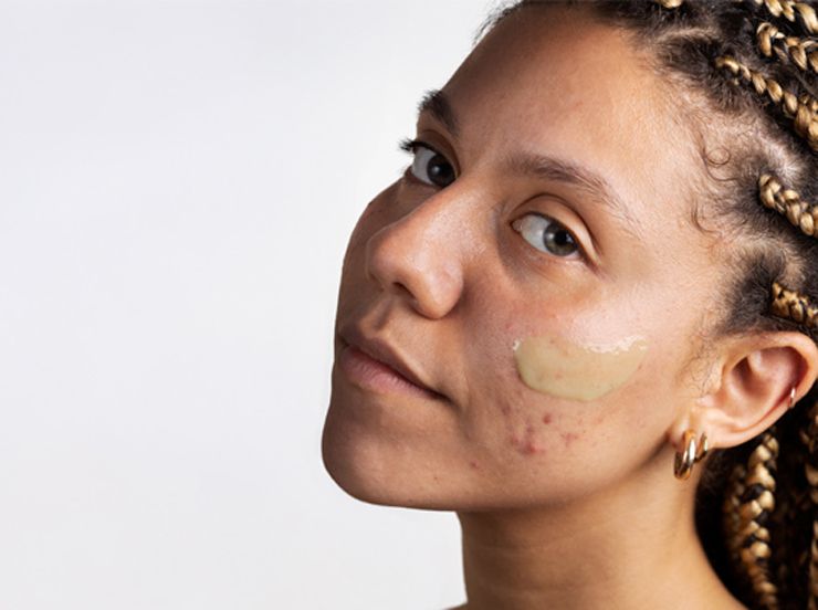 Skincare