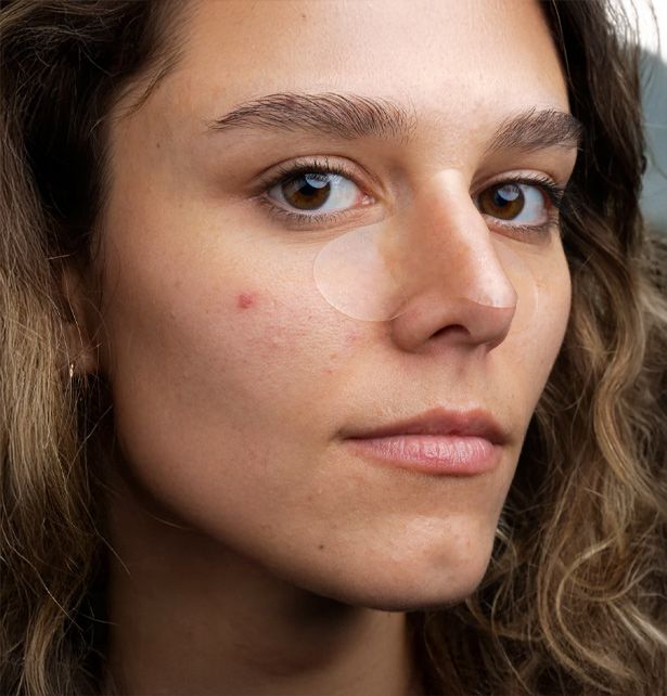 Comment enlever les points noirs naturellement ?