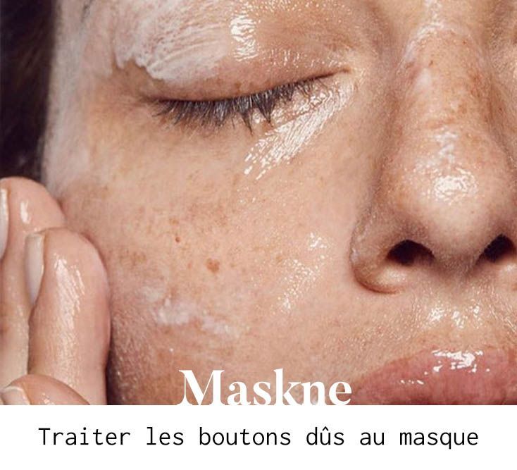Maskne Comment Se Debarrasser Des Boutons Dus Au Masque