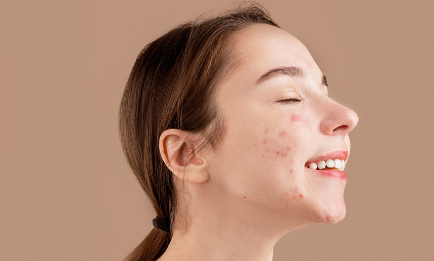 Soins visage bio et naturels pour ado